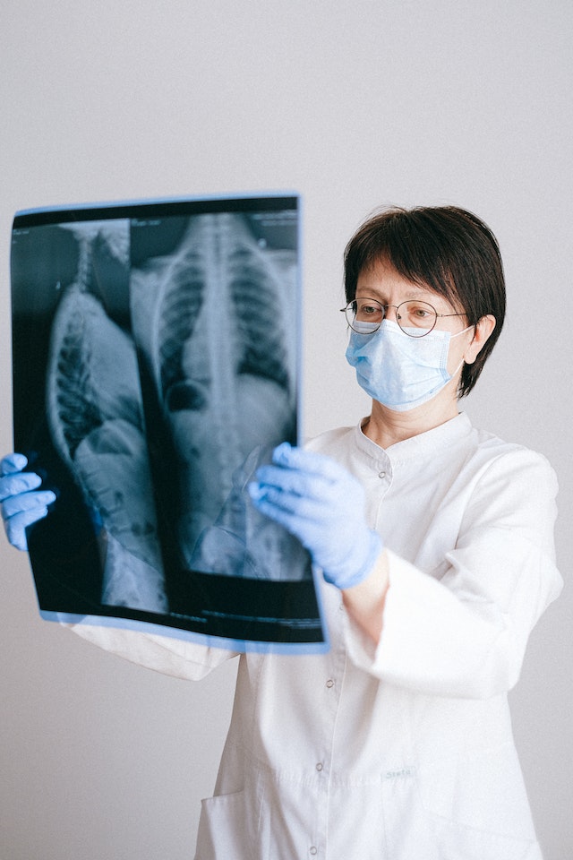 A healthcare professional holding up an X-ray film