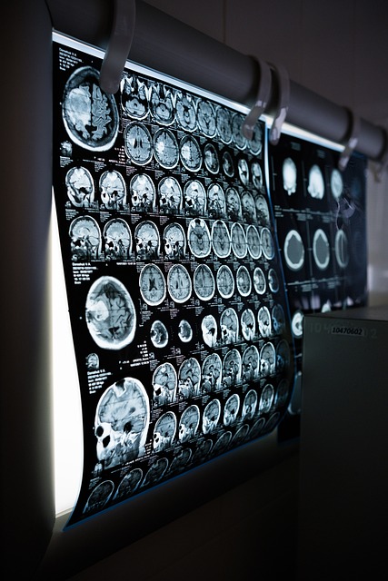 Film showing CT scan results